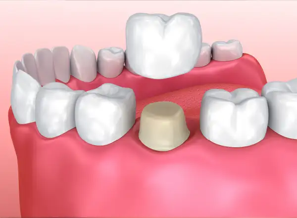 Latest Dental Technologies